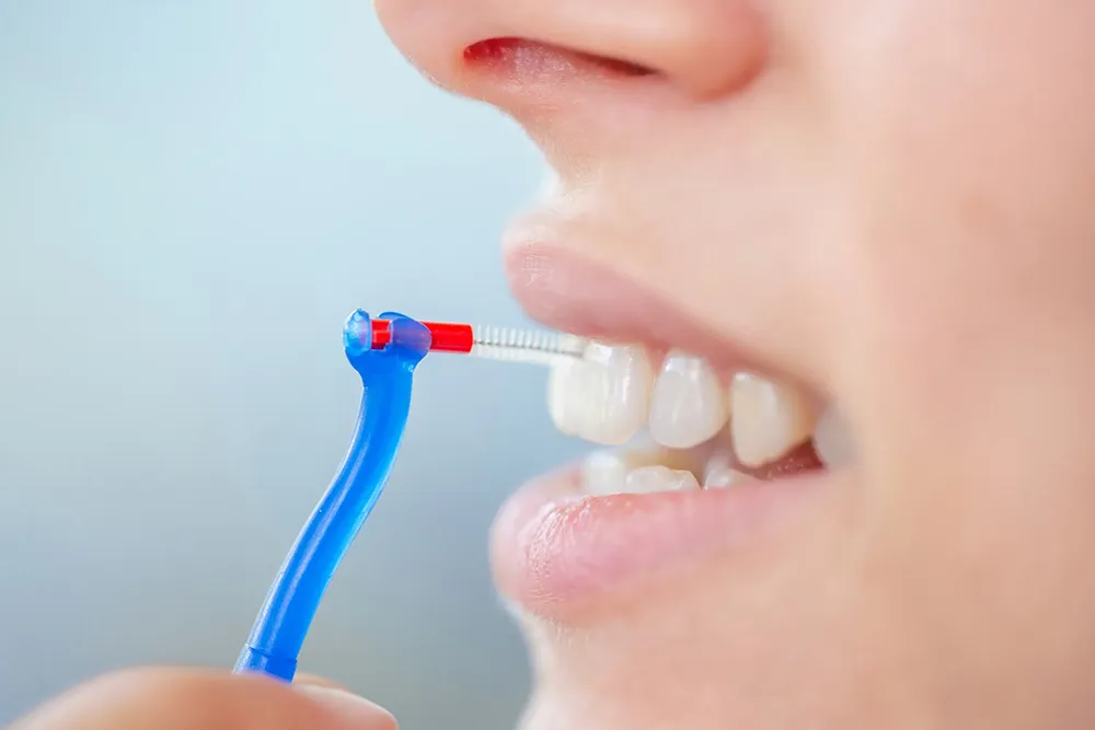 A maneira correta de usar uma escova interdental